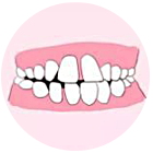 牙齿稀疏